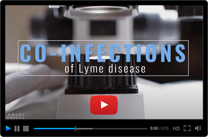 Signs and Symptoms of Lyme Disease