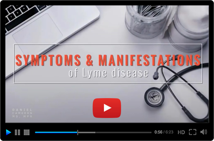 Signs and Symptoms of Lyme Disease