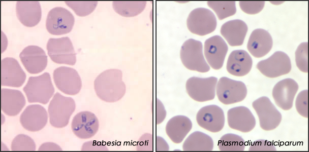 Babesia Treatments