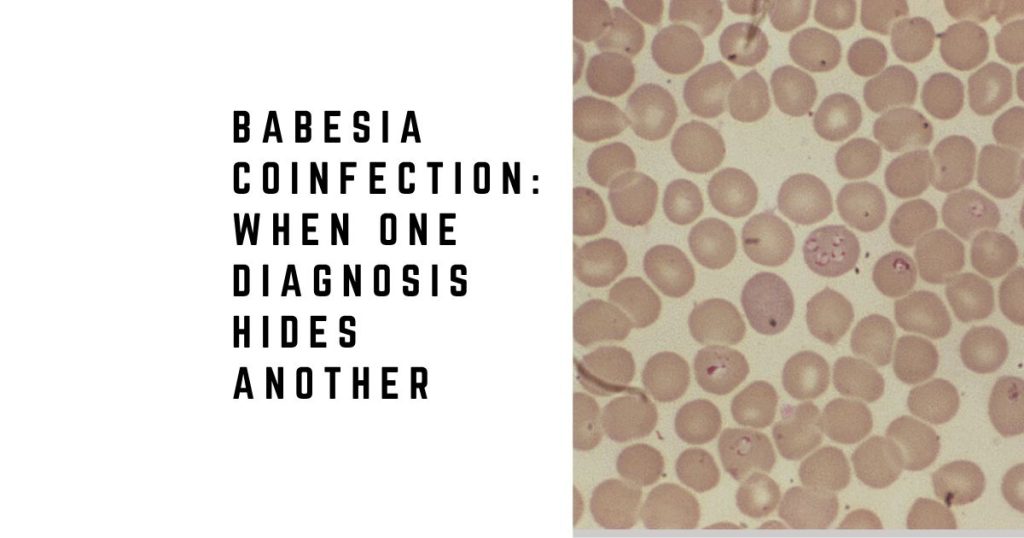 Babesia Coinfection: When One Diagnosis Hides Another
