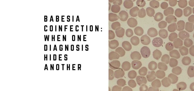Babesia Coinfection: When One Diagnosis Hides Another