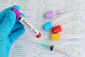 Blood sample for babesia parasite testing