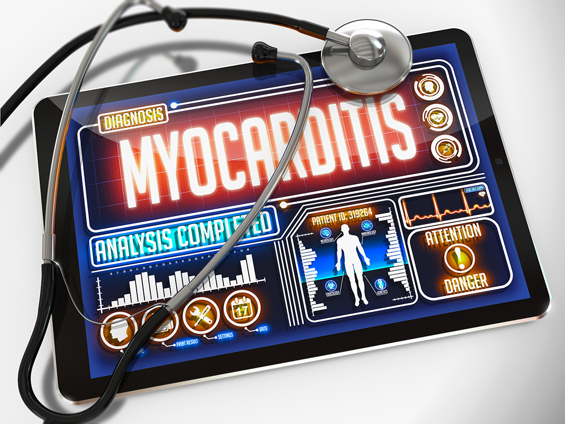 How Lyme myocarditis might present in an adolescent patient