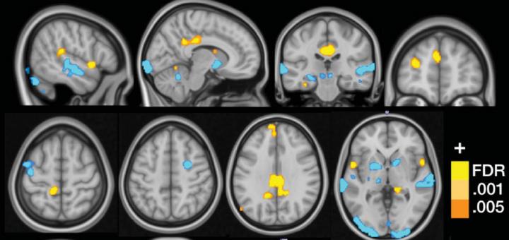 Credit: Cognitive and Affective Control Laboratory / University of Colorado Boulder.