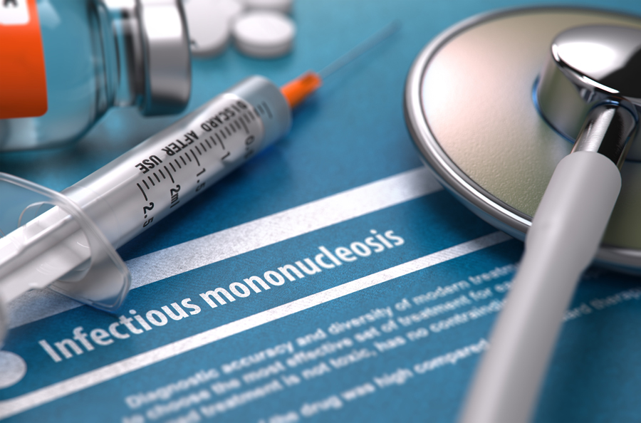 Infectious Mononucleosis (Mono) Symptoms, Diagnosis, and Treatment 