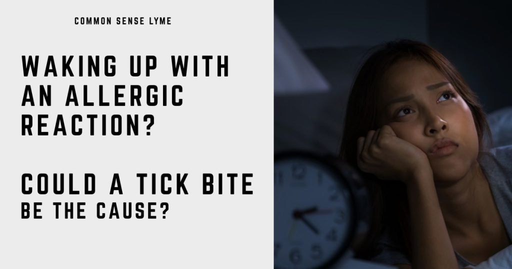 WAKING UP WITH AN ALLERGIC REACTION