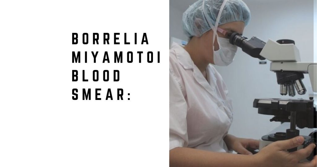 Borrelia Miyamotoi Blood Smear: