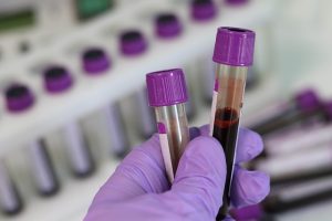 Blood smear tests reveal Babesia.