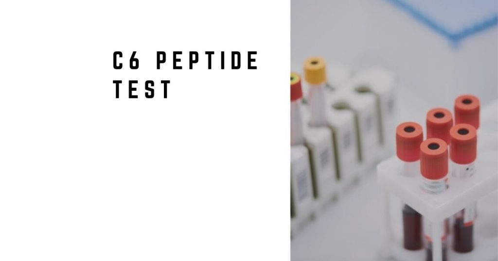 C6 peptide ELISA used for Lyme disease testing