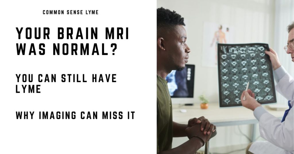 YOUR BRAIN MRI WAS NORMAL