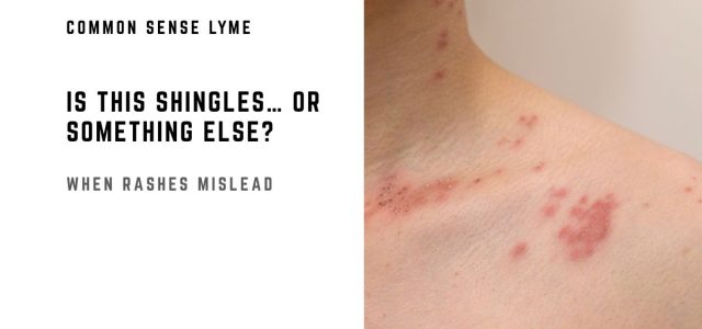 IS THIS SHINGLES… OR SOMETHING ELSE