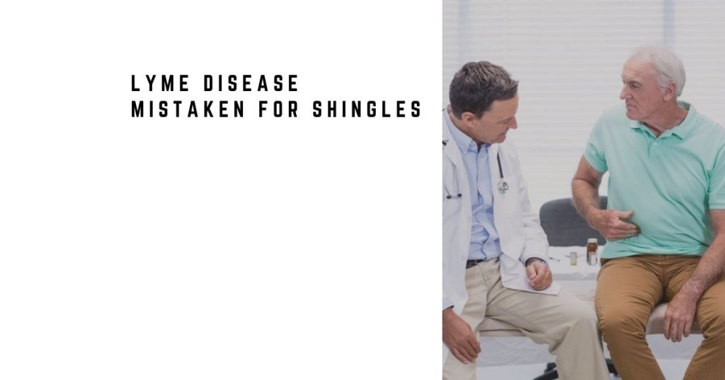 Lyme Disease Mistaken for Shingles