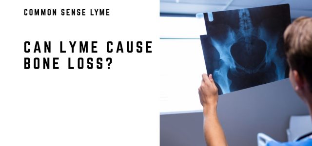 https://danielcameronmd.com/lyme-test-accuracy/
