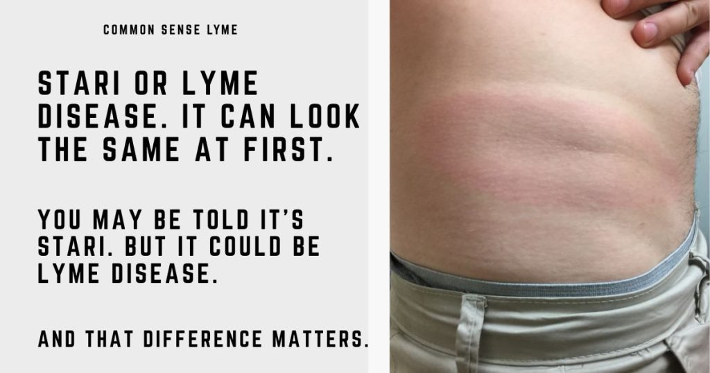 STARI OR LYME DISEASE (1)