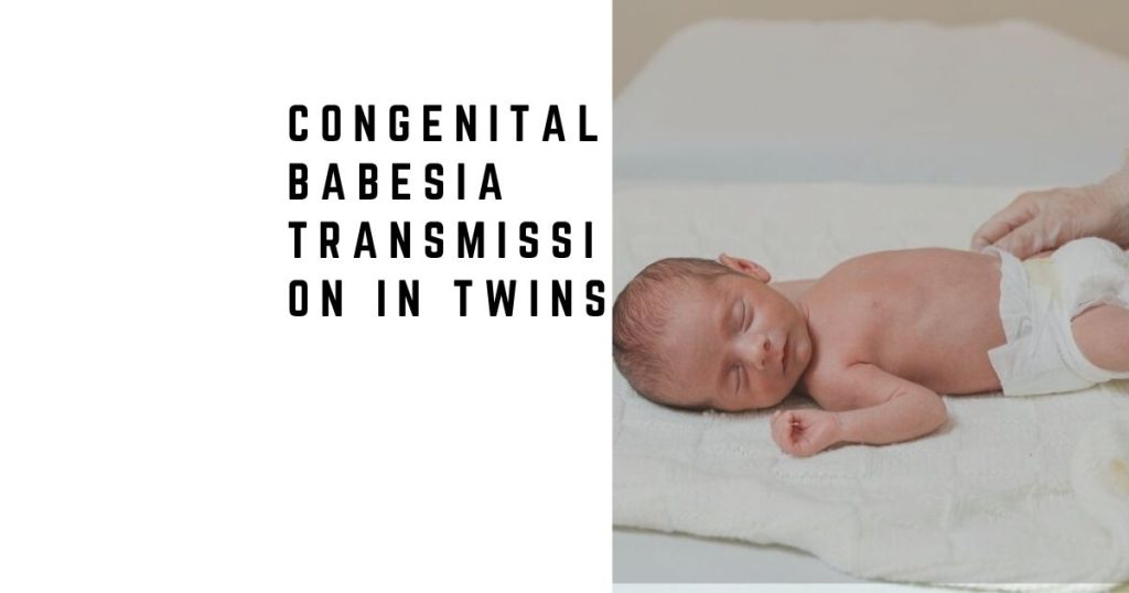 Congenital Babesia Transmission in Twins