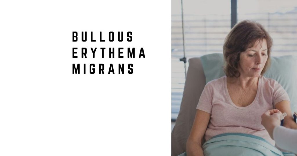 Bullous Erythema Migrans: