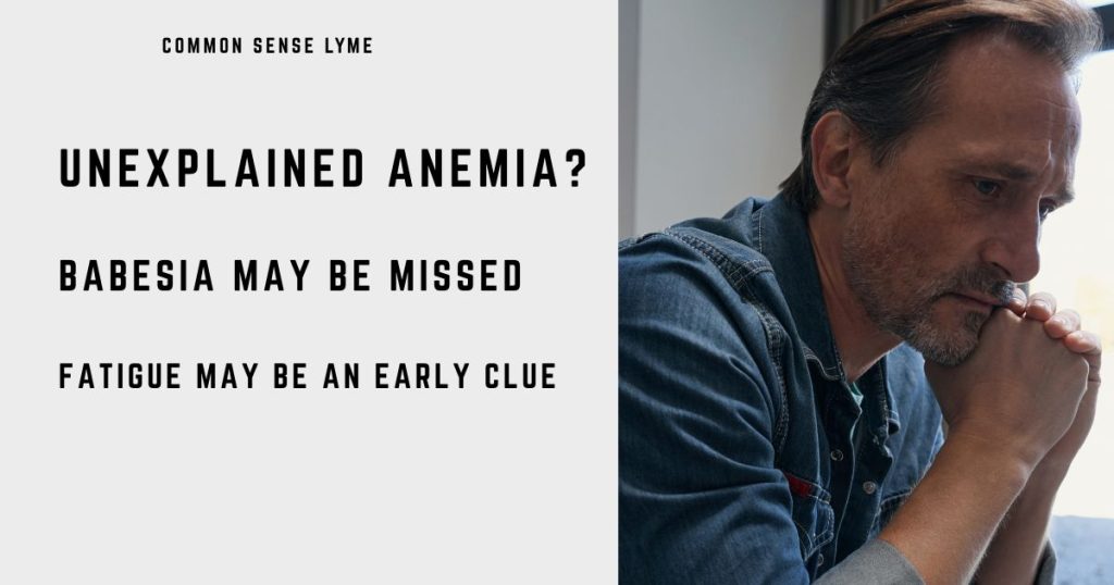 UNEXPLAINED ANEMIA BABESIA MAY BE MISSED