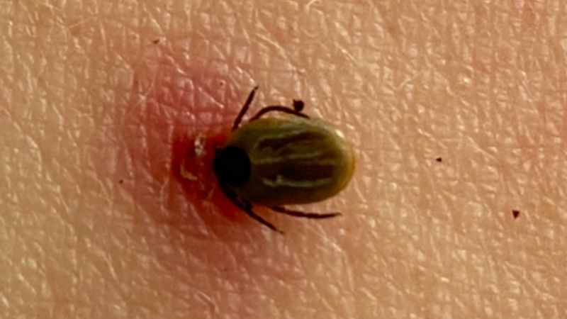 An engorged tick.