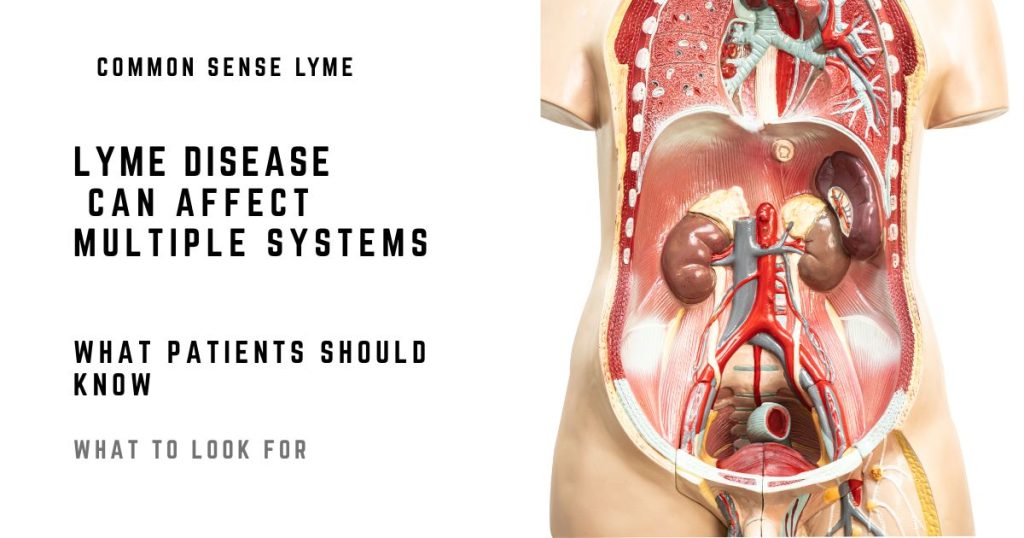 LYME DISEASE CAN AFFECT MULTIPLE SYSTEMS