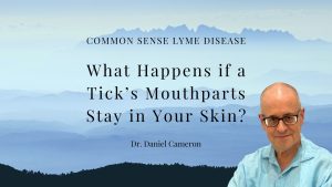 What Happens if a Tick’s Mouthparts Stay in Your Skin?
