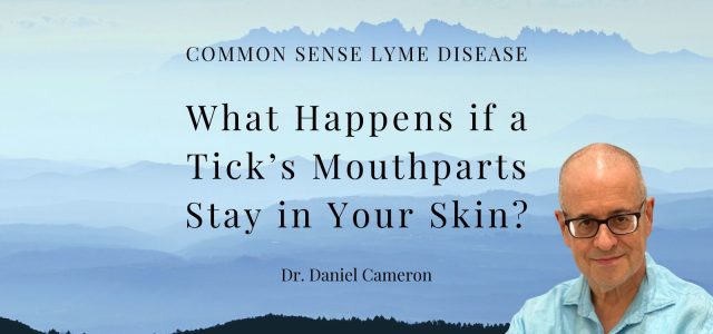 What Happens if a Tick’s Mouthparts Stay in Your Skin?
