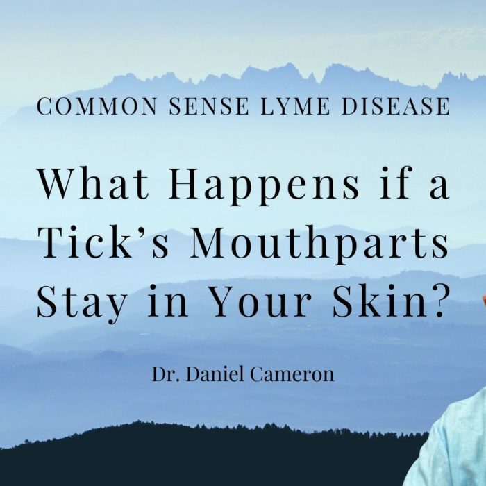 What Happens if a Tick’s Mouthparts Stay in Your Skin?