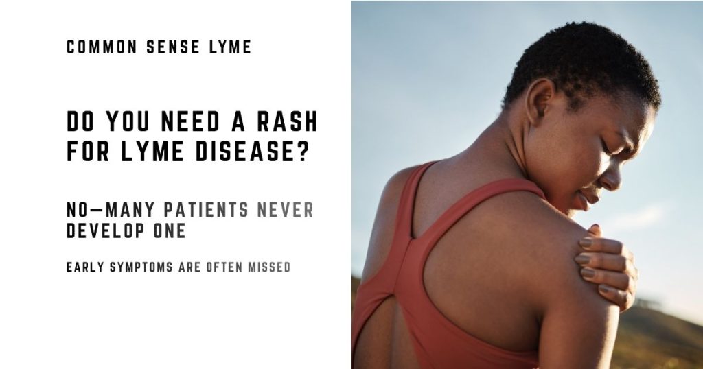 DO YOU NEED A RASH FOR LYME DISEASE?