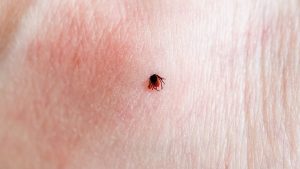 Lyme Rash Misdiagnosis: Not Every Rash Is a Bull’s-Eye