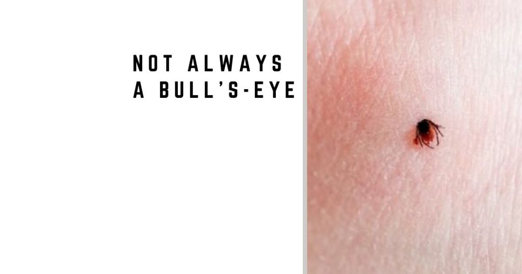 Not Always a Bull’s-Ey