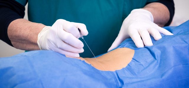 Spinal Taps for Lyme Disease: Do You Really Need One?