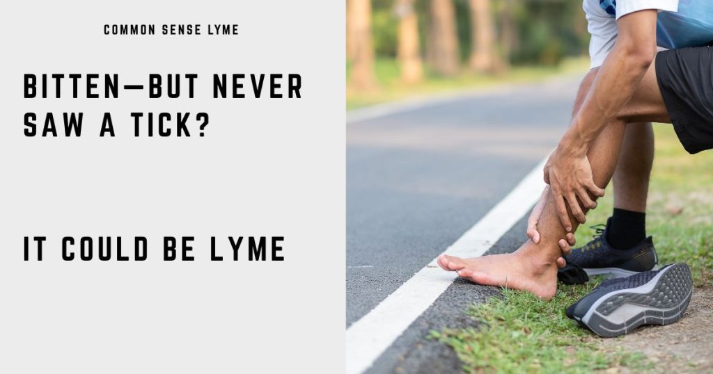 BITTEN—BUT NEVER SAW A TICK