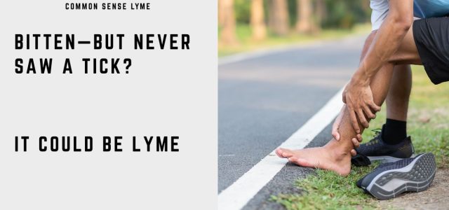 BITTEN—BUT NEVER SAW A TICK