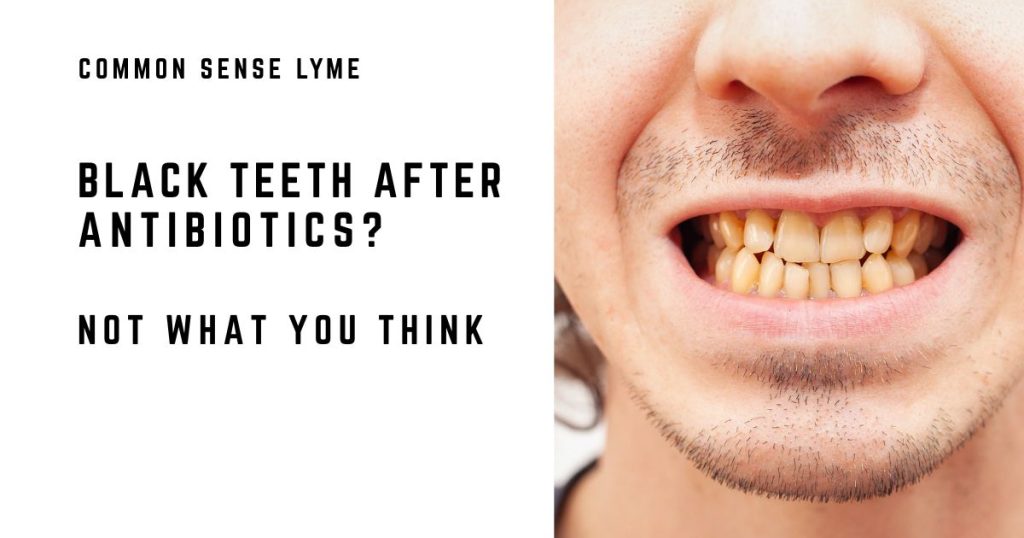 BLACK TEETH AFTER ANTIBIOTICS