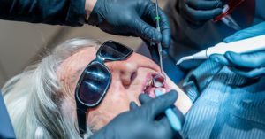 Black Teeth After Antibiotics in Lyme: A Case to Know