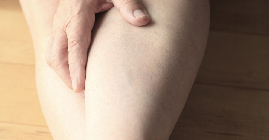 Child Limping: When to Worry About Lyme Disease