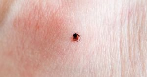 Can a tick bite make me sick years later?