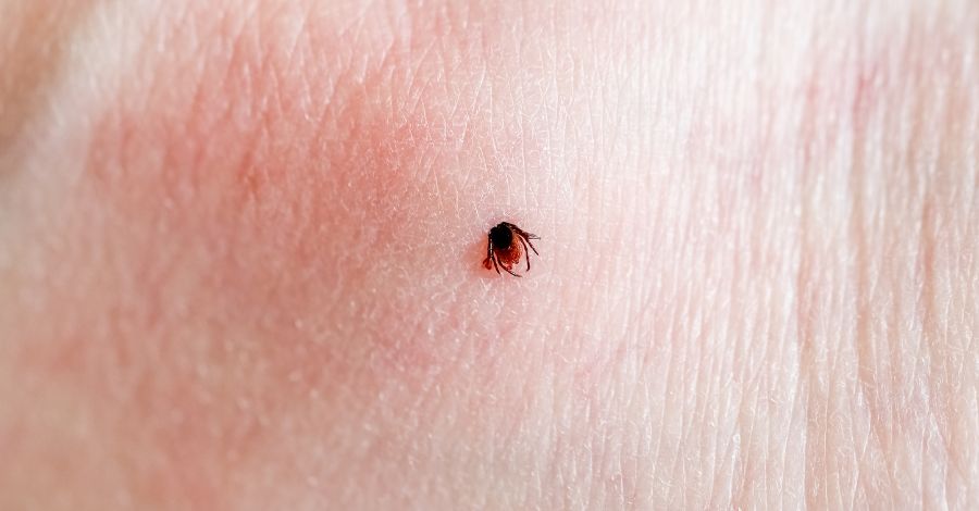Can a tick bite make me sick years later?