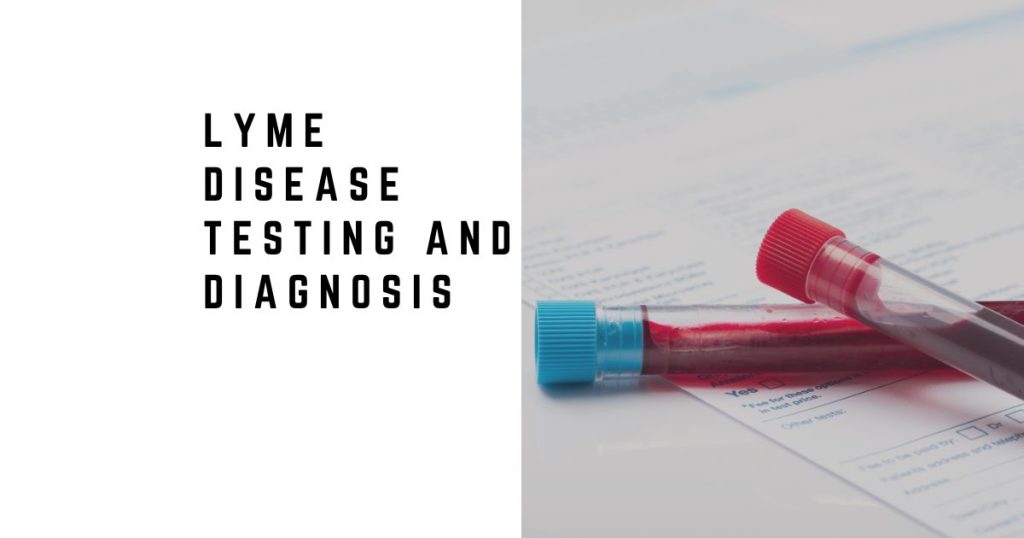 Lyme Disease Testing and Diagnosis