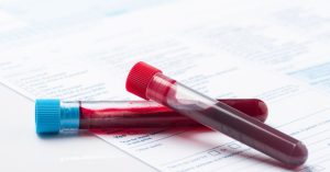 Lyme Disease Testing and Diagnosis