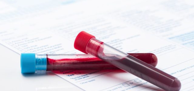 Lyme Disease Testing and Diagnosis