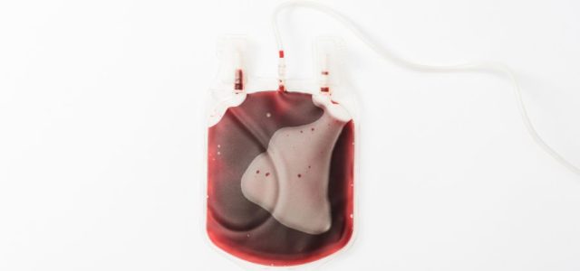 babesia blood supply