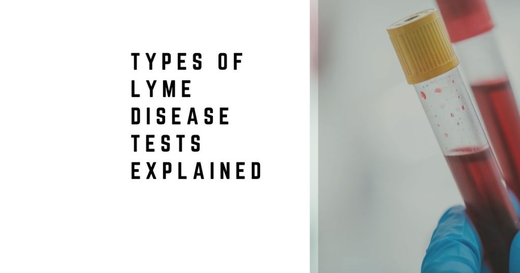 Types of Lyme Disease Tests Explained