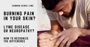 BURNING PAIN IN YOUR SKIN