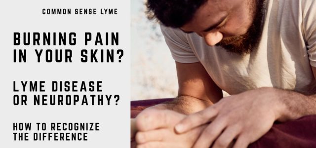 BURNING PAIN IN YOUR SKIN