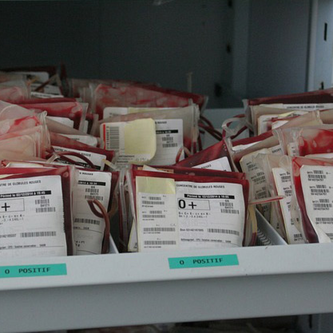 Blood donor infects premature infants with Babesia